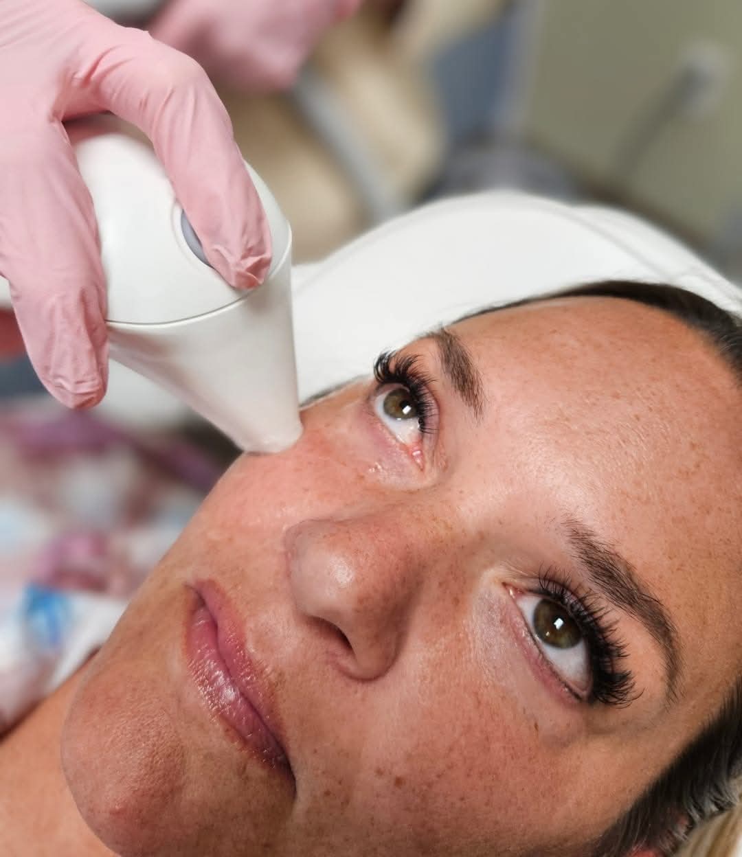 Endymed Face & Body Tightening and Contouring