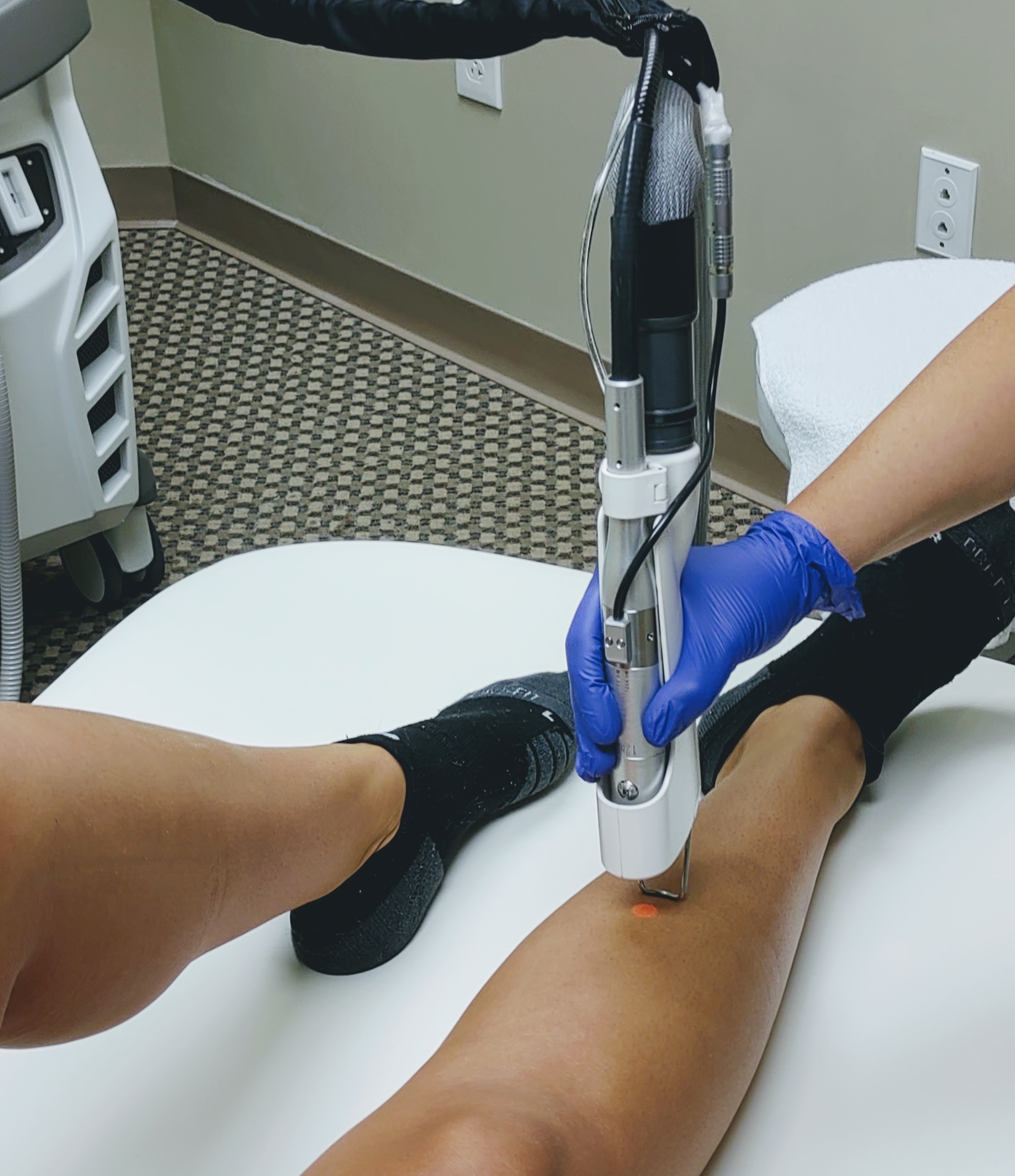 Laser hair removal treatment