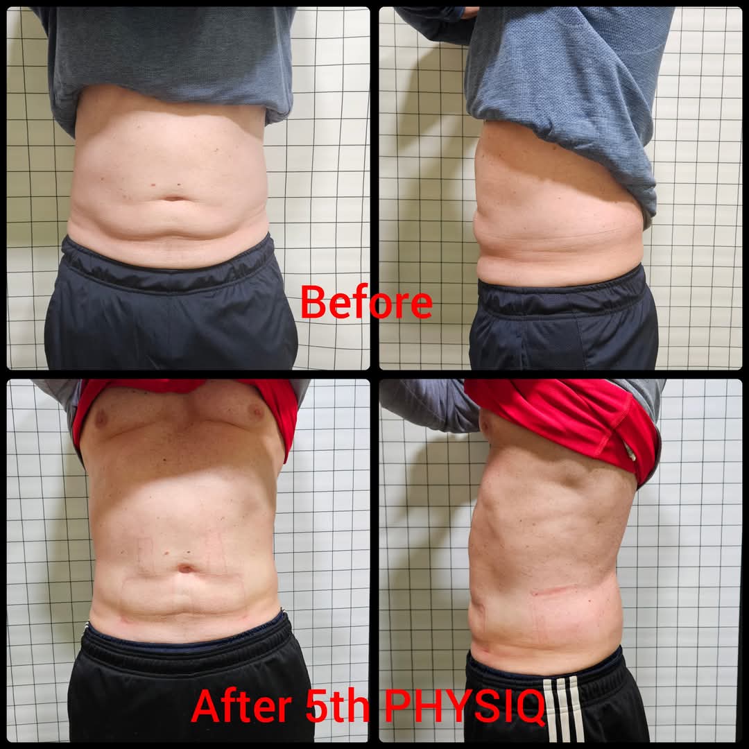 PHYSIQ Body Treatment