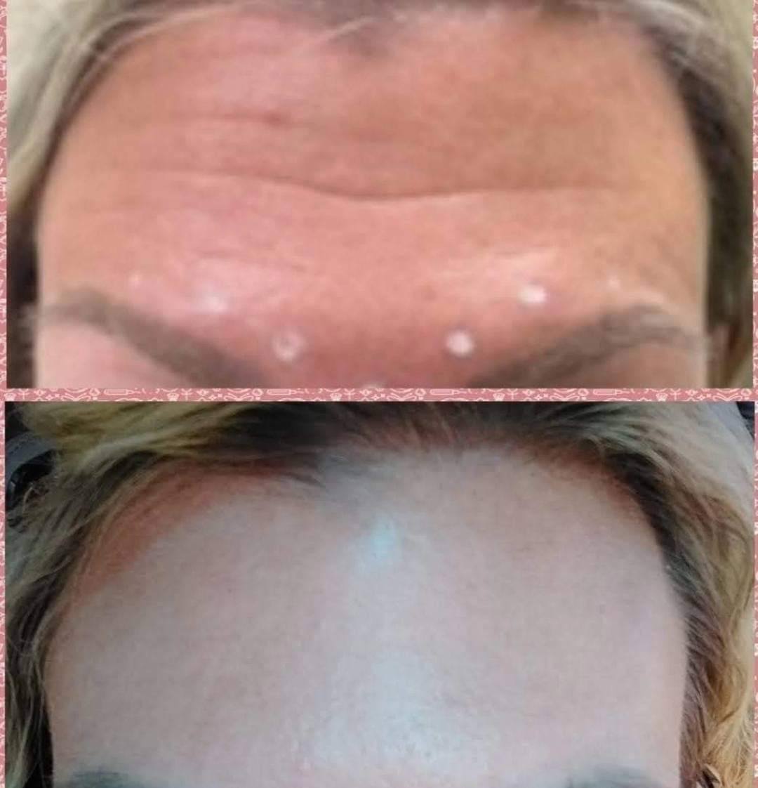 Before and after example 1