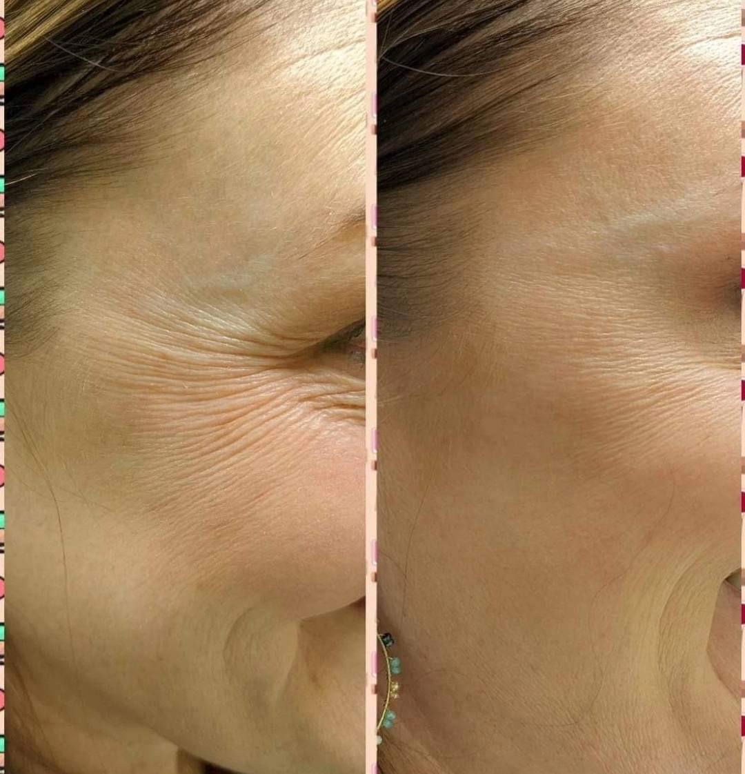 Before and after example 2