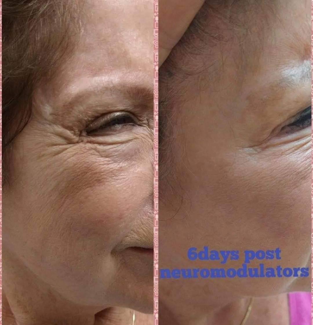 Before and after example 3