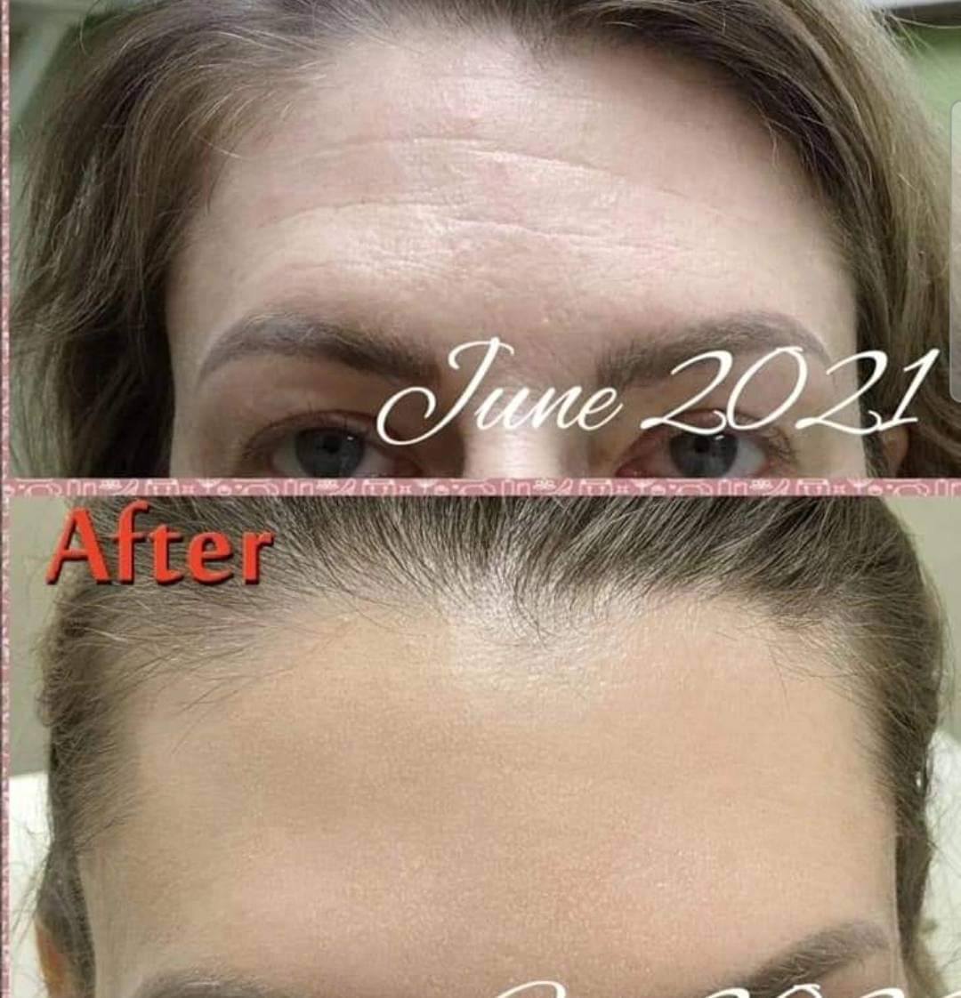 Before and after example 4